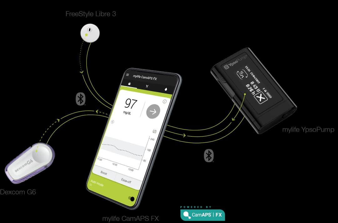 Darstellung eines Android-Handys mit mylife Loop sowie dem FreeStyleLibre 3 und dem Dexcom G6
